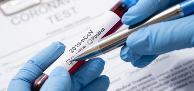 teste_coronavirus_freepik