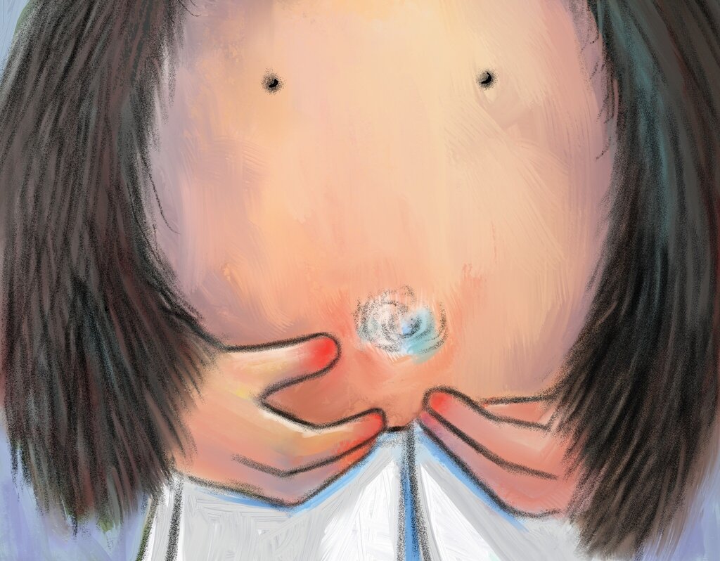 A misteriosa coleção de bolinhas de cotão no umbigo