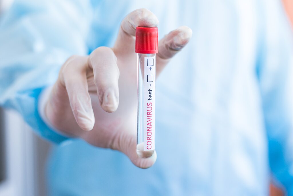 MUNICÍPIO DE VAGOS NA PRIMEIRA LINHA DA TESTAGEM A LARES DO CONCELHO 